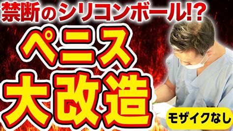 改造チンポとは|シリコンボールを陰茎に埋め込むメリットとデメリットを解説【。